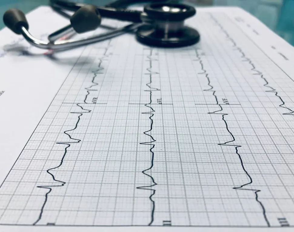 Increased Risk of Atrial Fibrillation for Multiple Myeloma Patients image