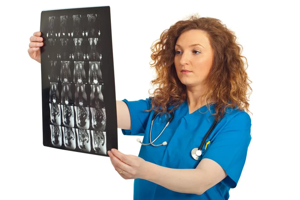 Whole Spine MRI Screening At Myeloma Diagnosis Is Not Always Beneficial image
