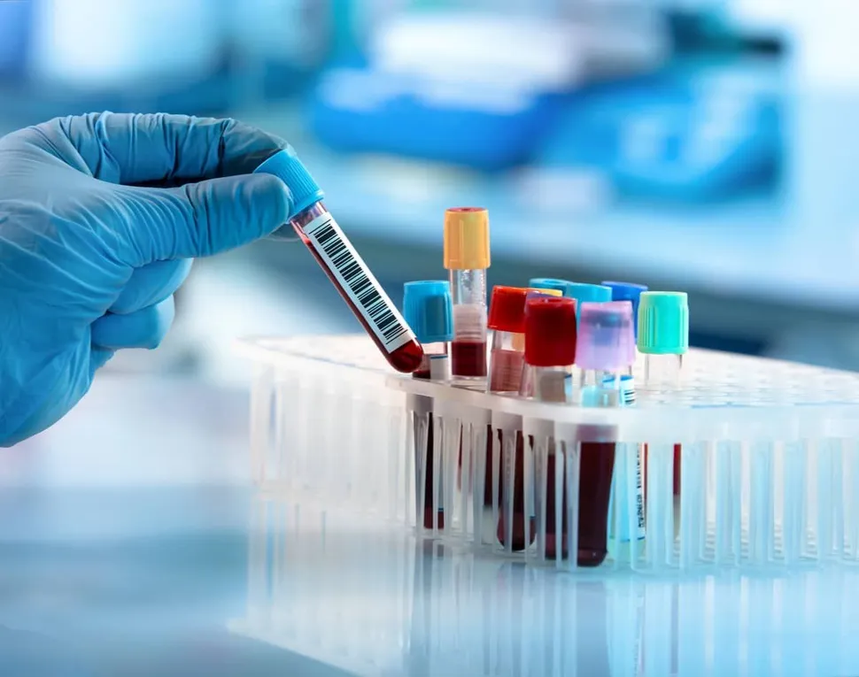 MRD Negativity is Better than Stringent Complete Response (sCR) to Determine Myeloma Patient Outcomes image