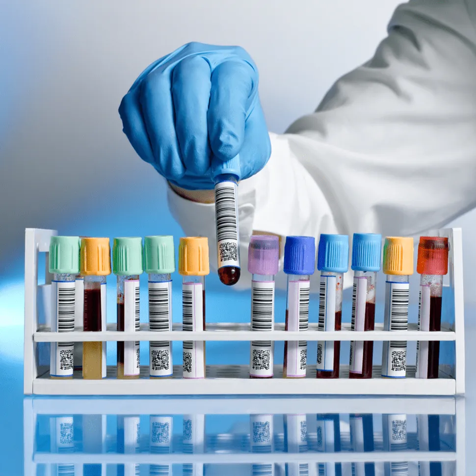 Know Your Myeloma Labs image